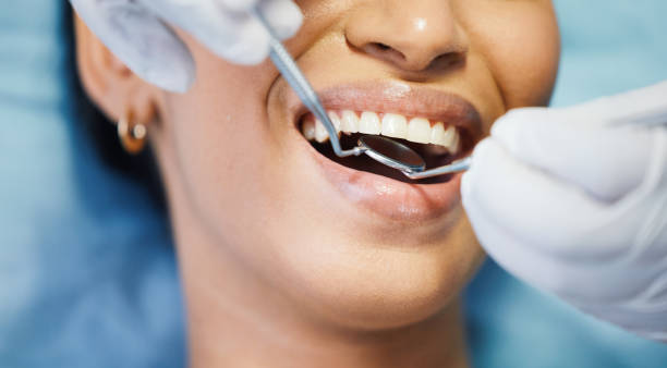 Best Emergency Treatment for Toothache in Audubon Park, NJ