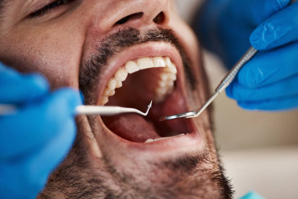  Audubon Park, NJ Emergency Dentist Pros