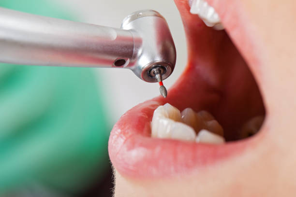 Best Emergency Treatment for Toothache in Audubon Park, NJ